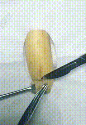 香蕉（包皮）手术搞笑动图